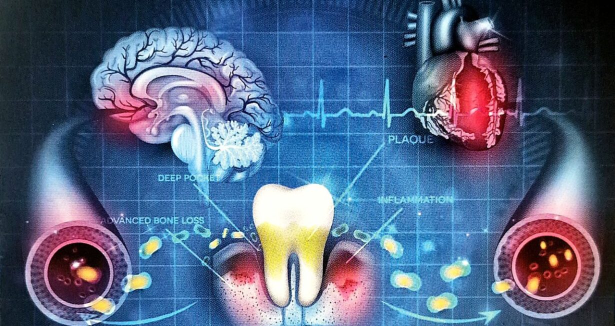 Metodo Argo: Medicina Oro-Sistemica per una Salute Personalizzata 3 Medicina Oro-Sistemica