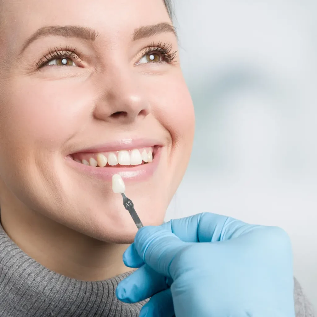 Faccette Dentali A Bologna